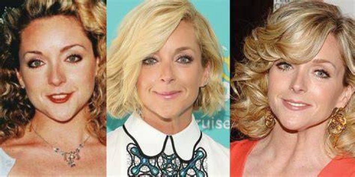 Jane Krakowski Plastic Surgery Before and After Botox Injections