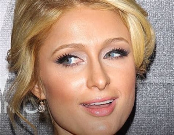 Paris Hilton Breast Implants Plastic Surgery Before and After
